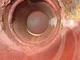 View Hyco Corp Vertical Coalescing Filter Vessel, 16" x 3', SN 91-40 image 4